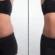 weight gain